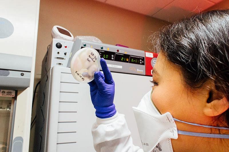 Anh Diep studies Coccidioides in the lab. Read more about the surge in Valley Fever research at California universities on KVPR Valley Public Radio. Credit: Lauren J. Young